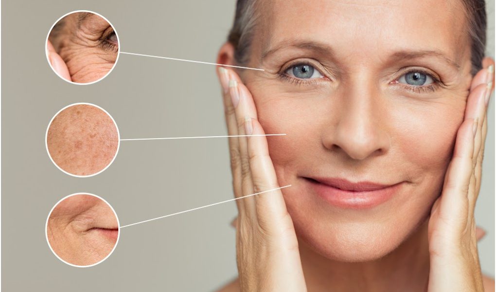 Midlife Female With Skin Magnification Of Laugh Lines and Fine Lines Around Eyes